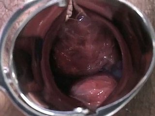 Senhora grávida japonês é examinado e suga lollicock gain médico